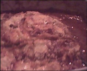 Lasagna de beringela